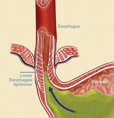 Diagram of esophagus and stomach