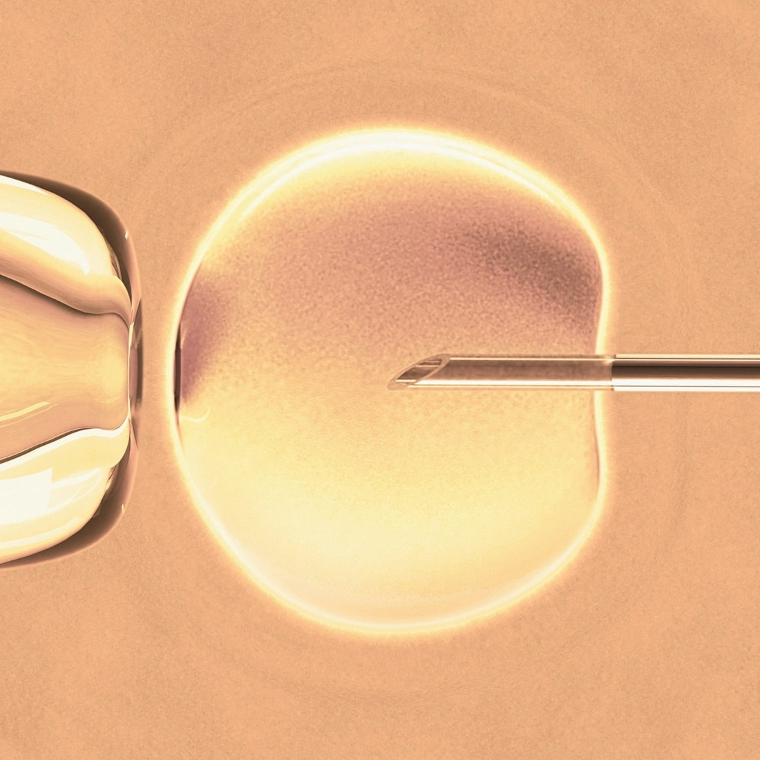 Microscopic view of IVF