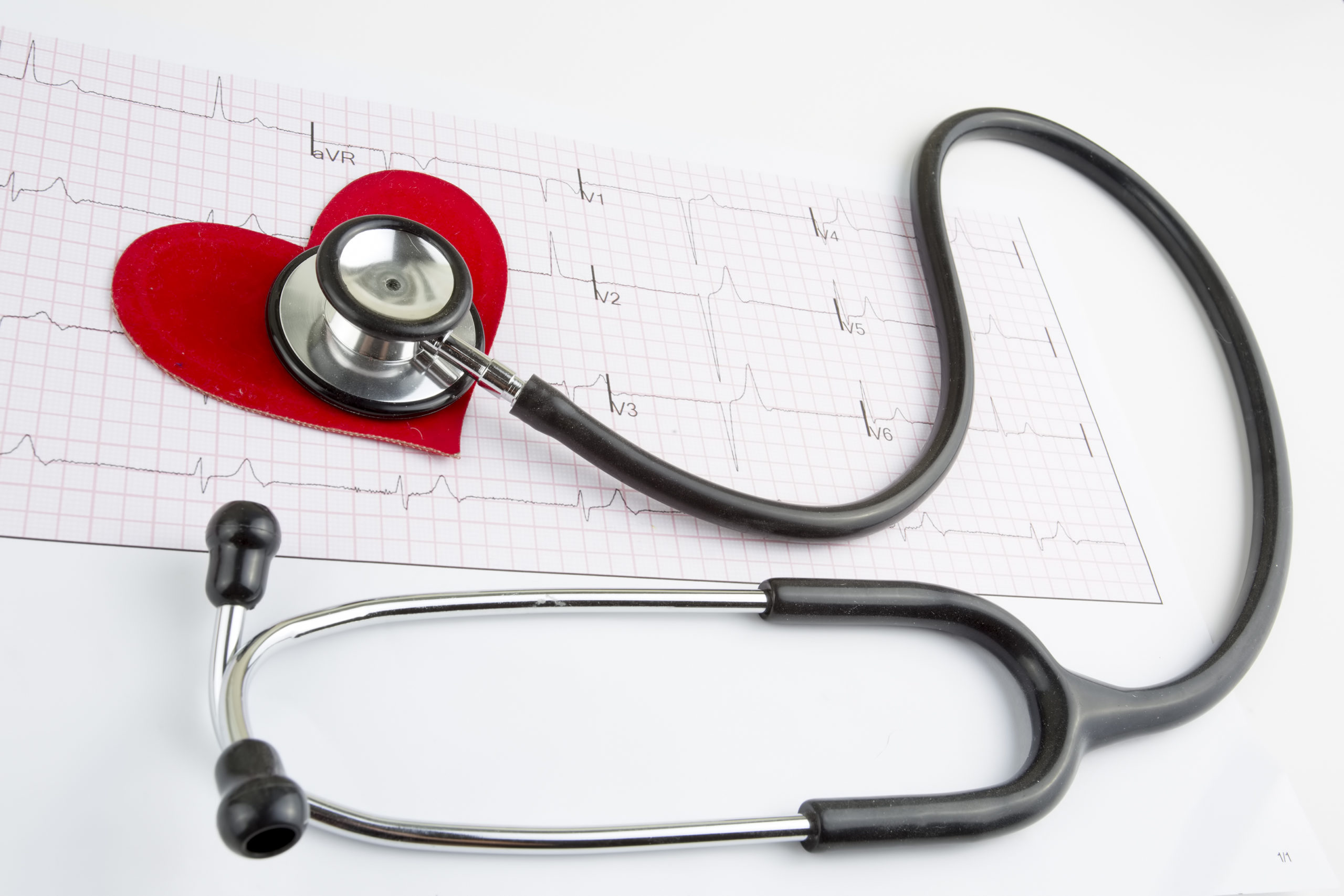 A stethoscope over a paper heart and EKG printout