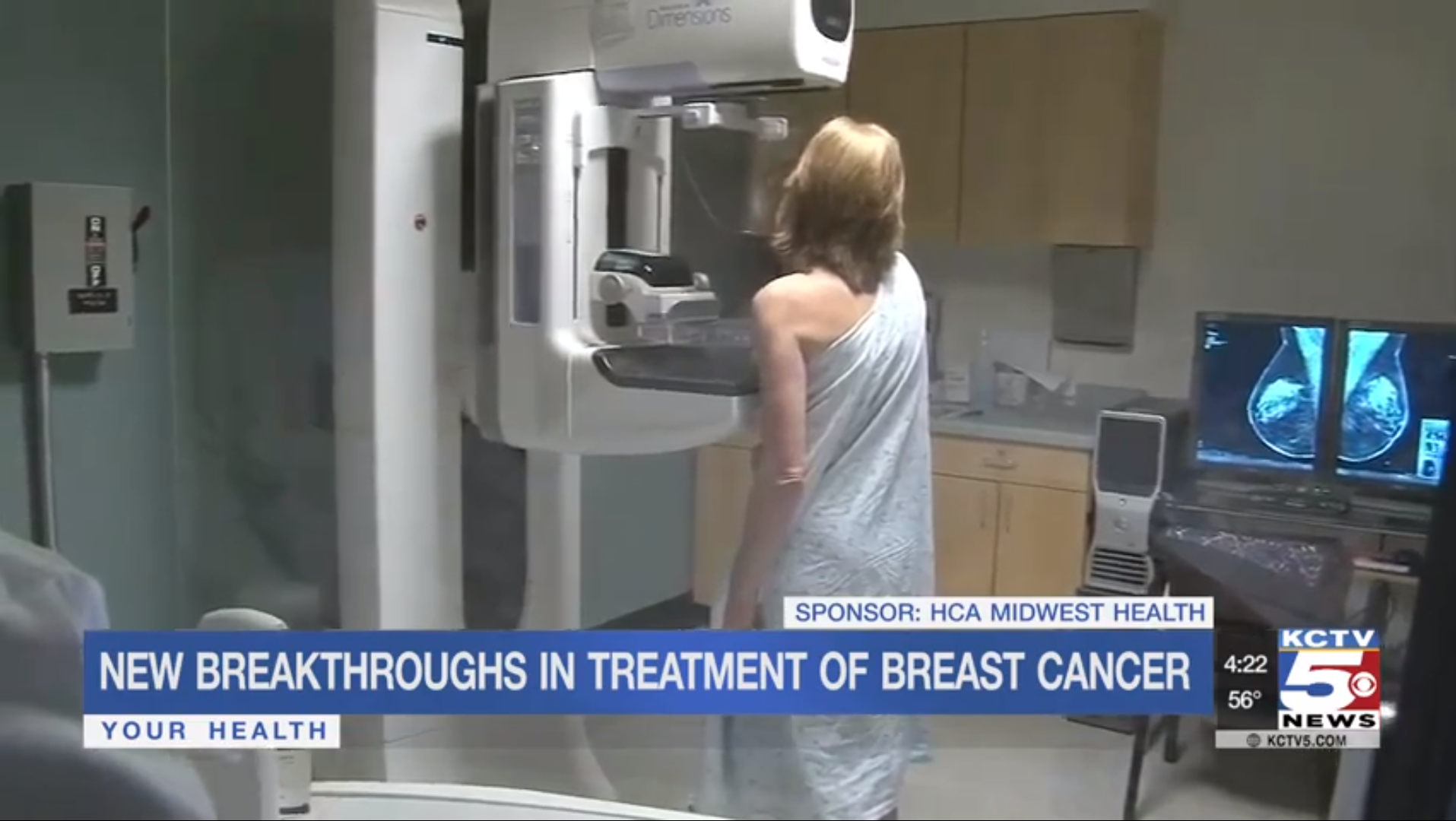 A news segment about breast cancer showing the back of a woman during a mammogram 