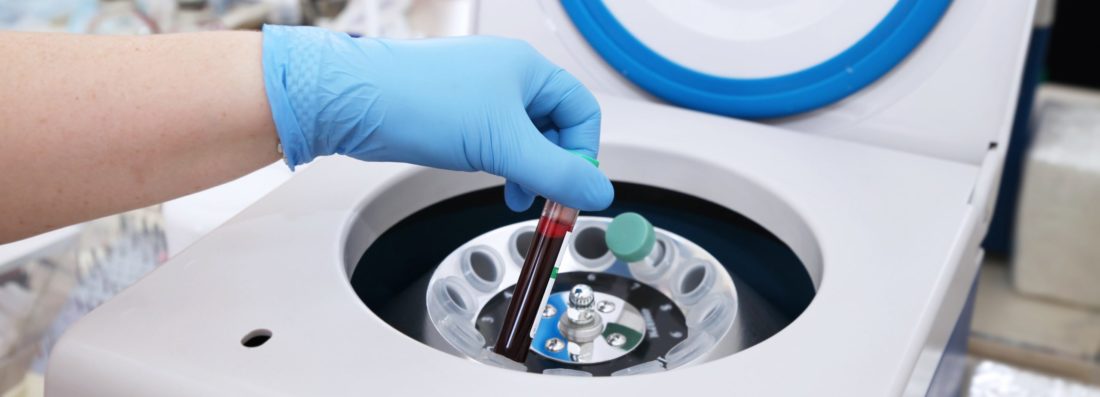 Tube of blood being placed in a medical centrifuge for plasma lifting