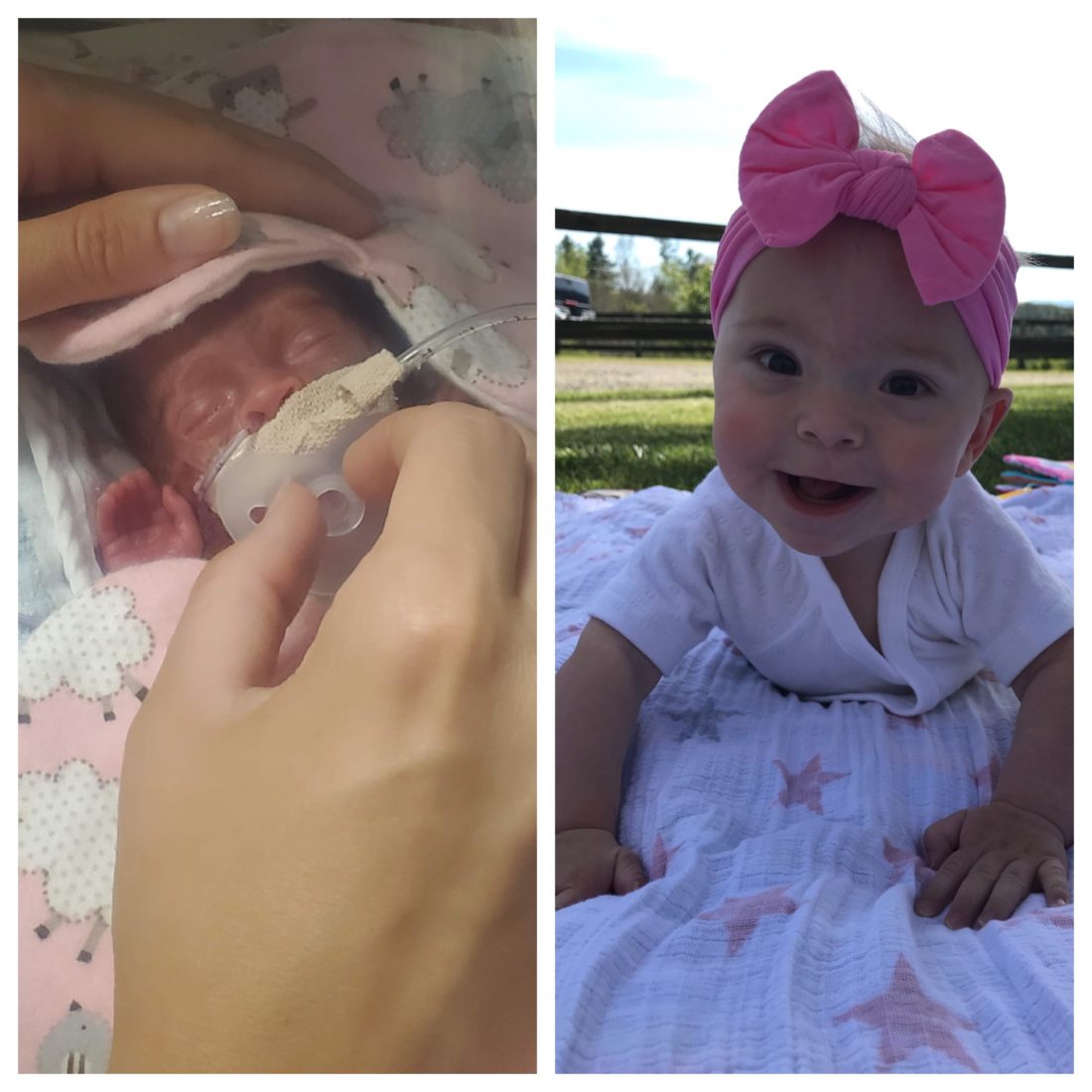 On left, a newborn baby in the NICU, and on right, the same baby playing outside. 