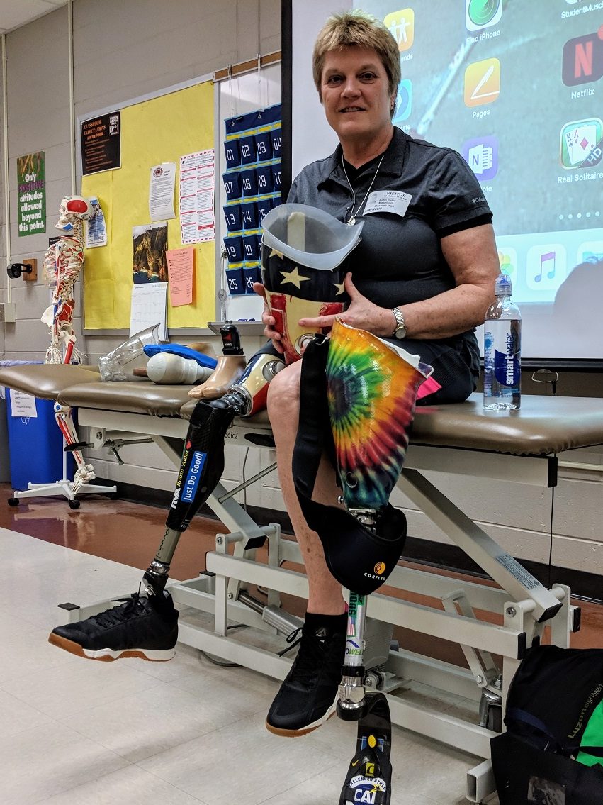 Woman sitting down while talking to class about her prosthetic leg.